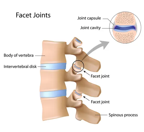Lumbar Facet Injury