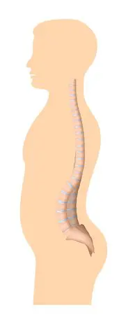 Treat Your Abnormal Spine Curvature Correctly - kyphosis, lordosis