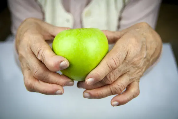 Close-up view of a person with arthritis in their hands holding an apple.