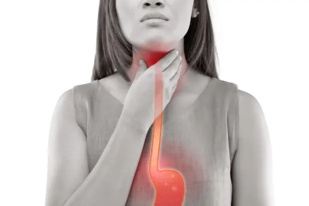 Woman that is holding her neck with a model view of her upset stomach and esophagus with heartburn.