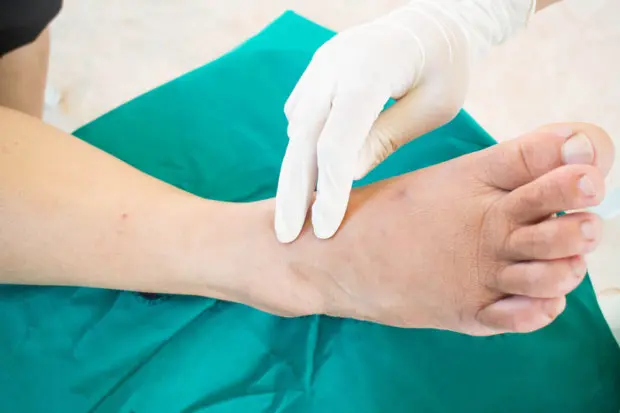 A professional that is testing the nerves in a patient's foot.