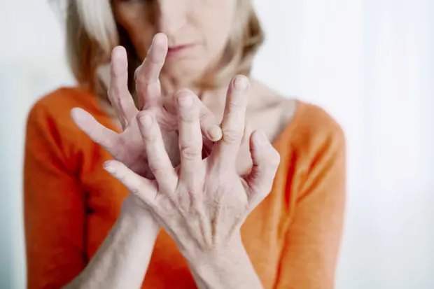 A close-up view of a woman's hands that have arthritis in the joints. The joints are swollen with visible signs of the arthritis. The hands are clear and her image behind is more blurry.
